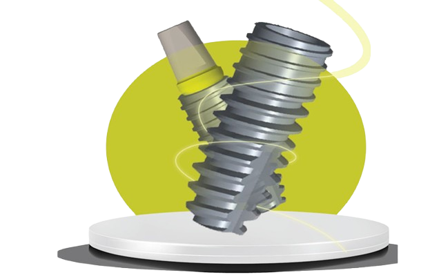 Dental Implants in Chandigarh