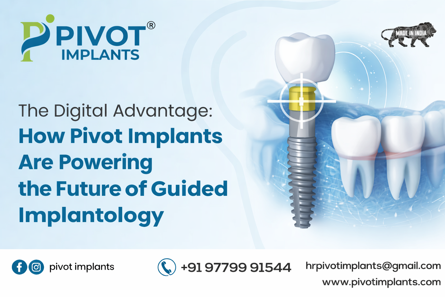 The Digital Advantage: How Pivot Implants Are Powering the Future of Guided Implantology
