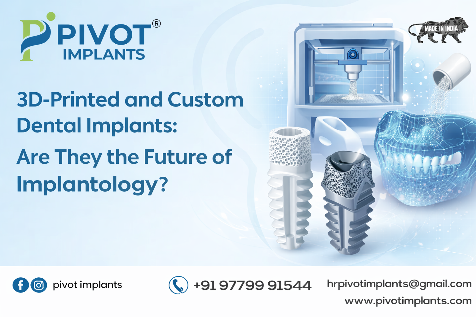 3D-Printed and Custom Dental Implants: Are They the Future of Implantology?
